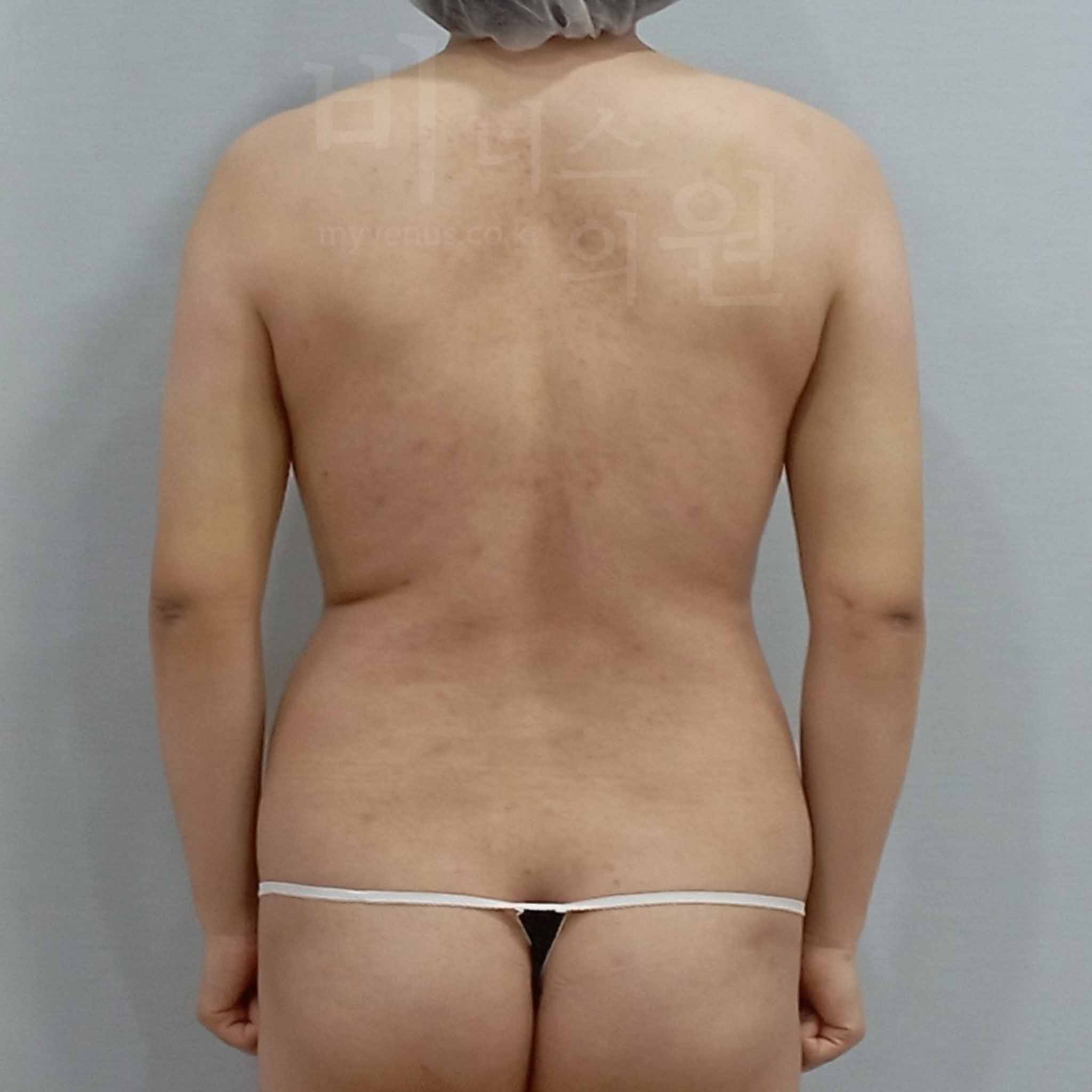 봄 맞이 다이어트.jpg