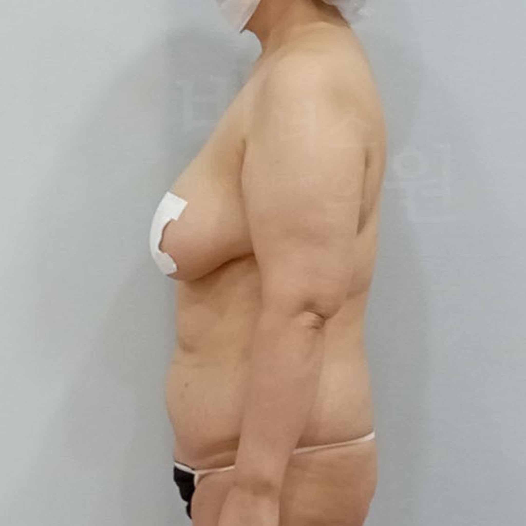 울퉁불퉁함 없이 매끄럽게 정리된 팔 라인

.jpg