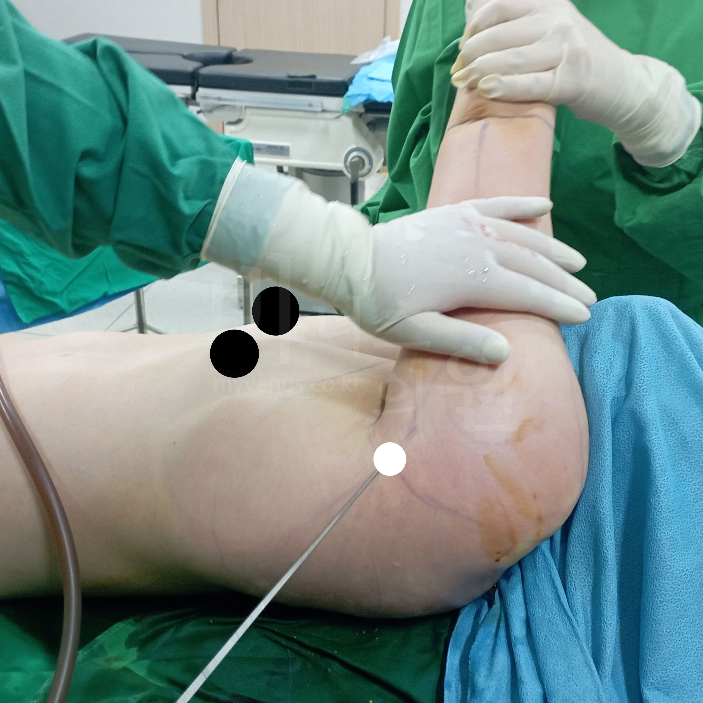 직선화된 팔뚝 라인과 자연스러운 상체 실루엣 변화.jpg