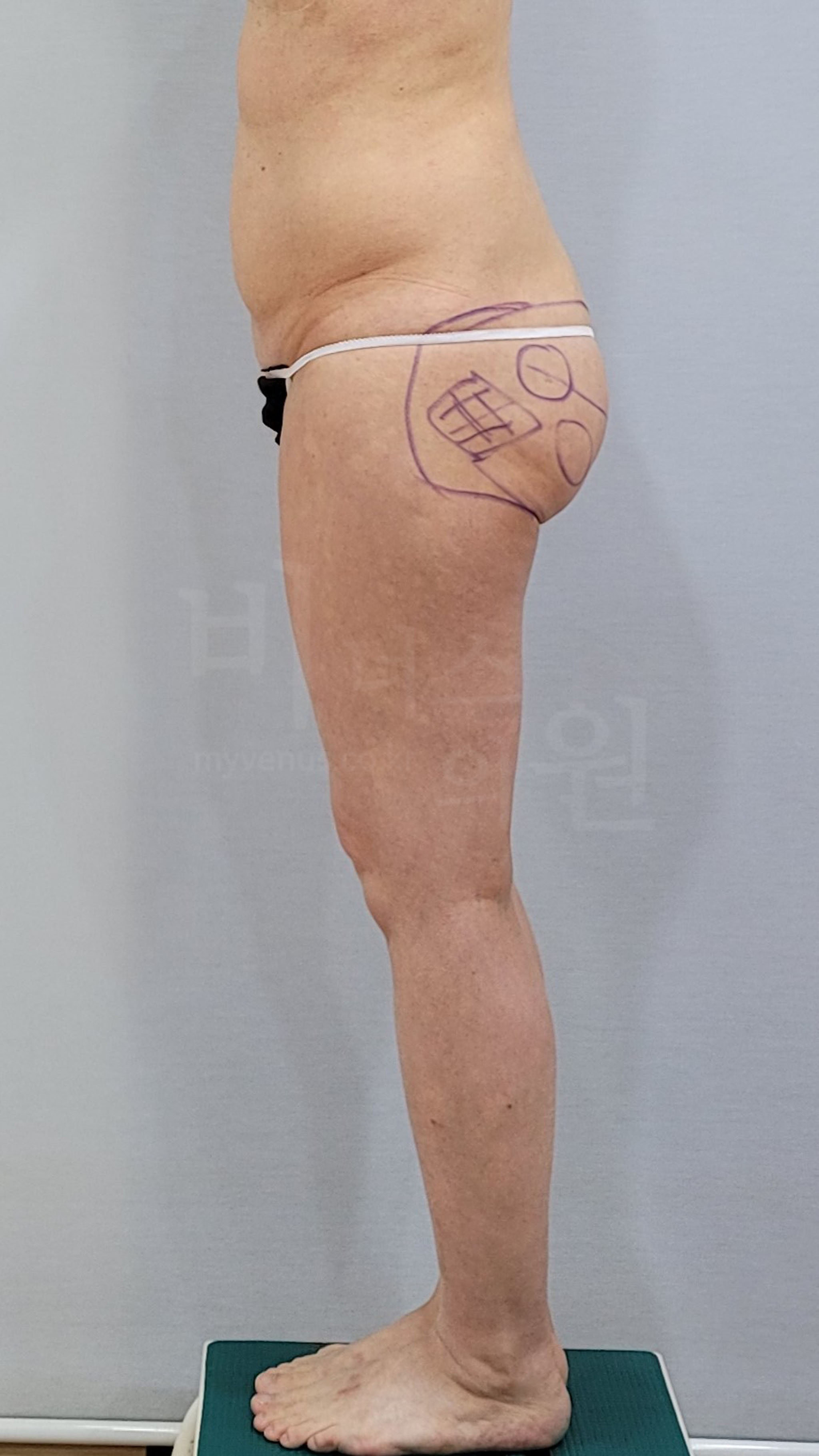 힙딥꺼짐.jpg