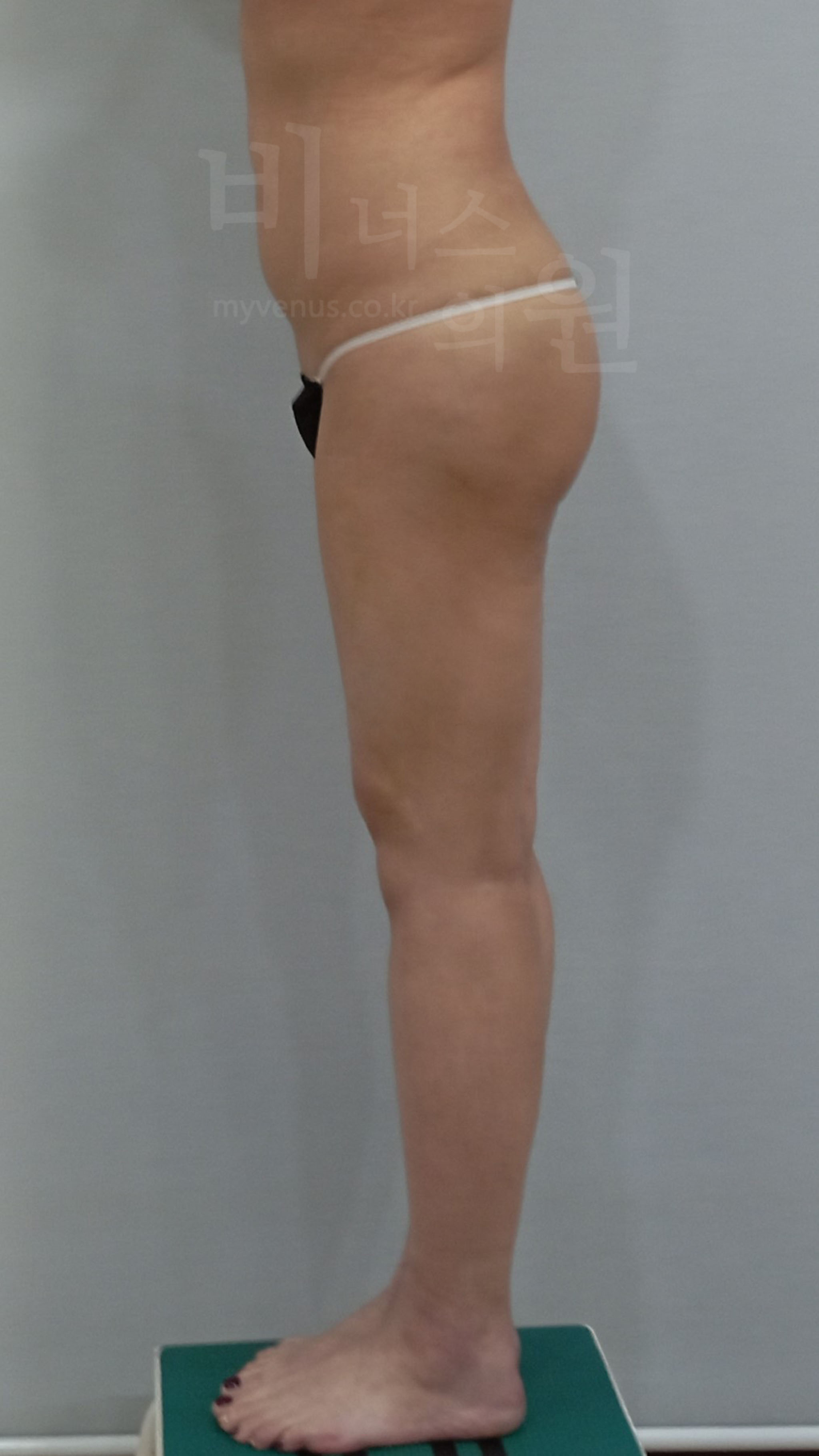 엉덩이 볼륨업.jpg