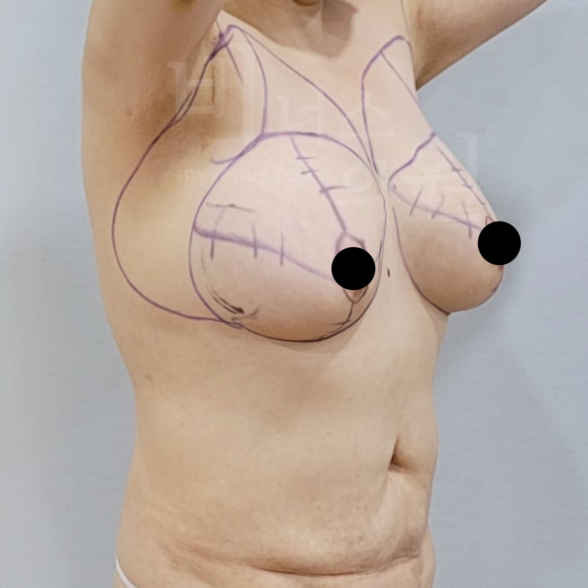 밸런스 회복.jpg