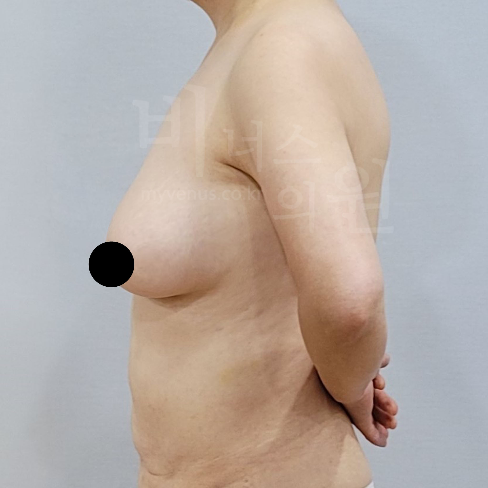 옷맵시 향상.jpg