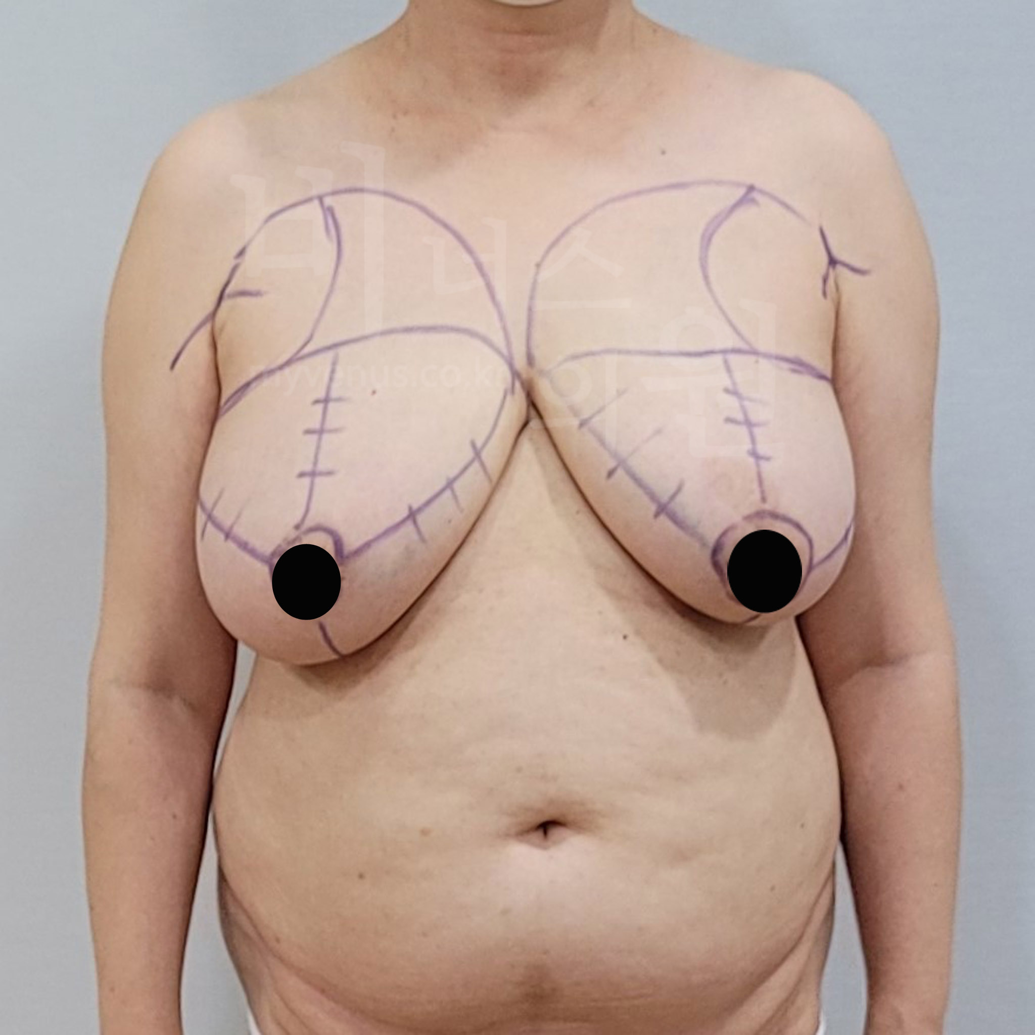 자신감 회복.jpg