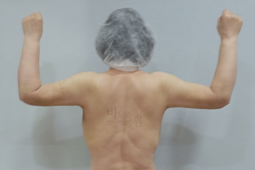 팔뚝2.jpg