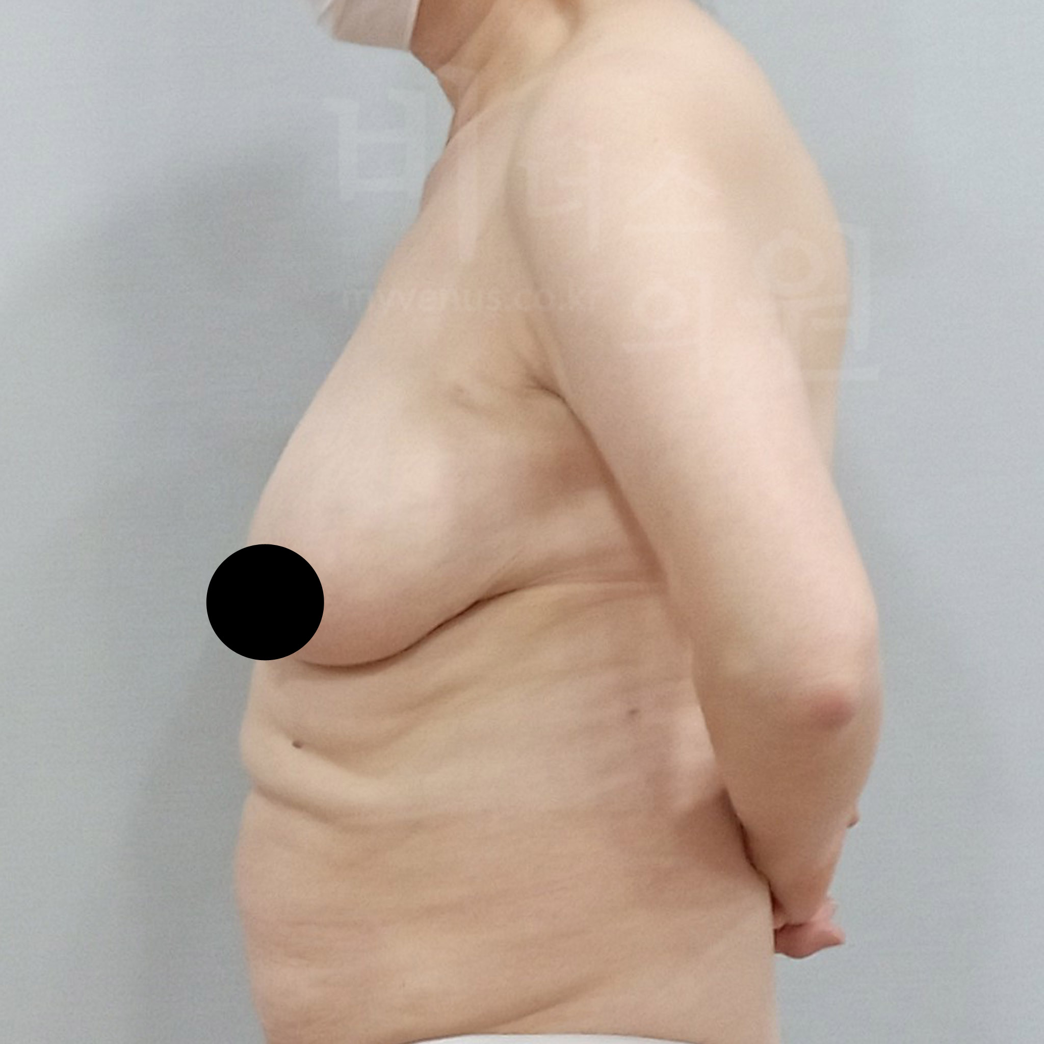 상체 라인 개선.jpg