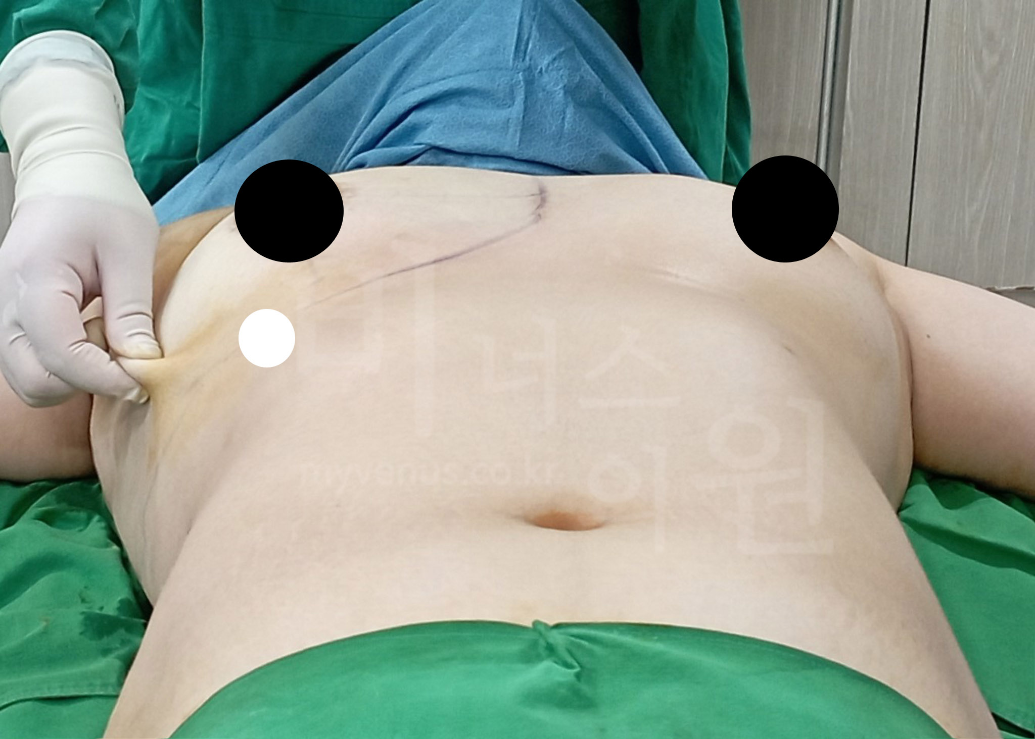 유방 성형 전문병원.jpg