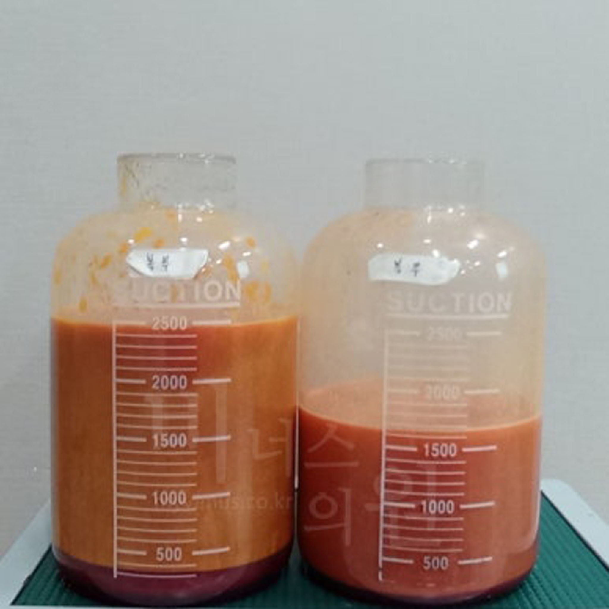 지방 제거 전후.JPG