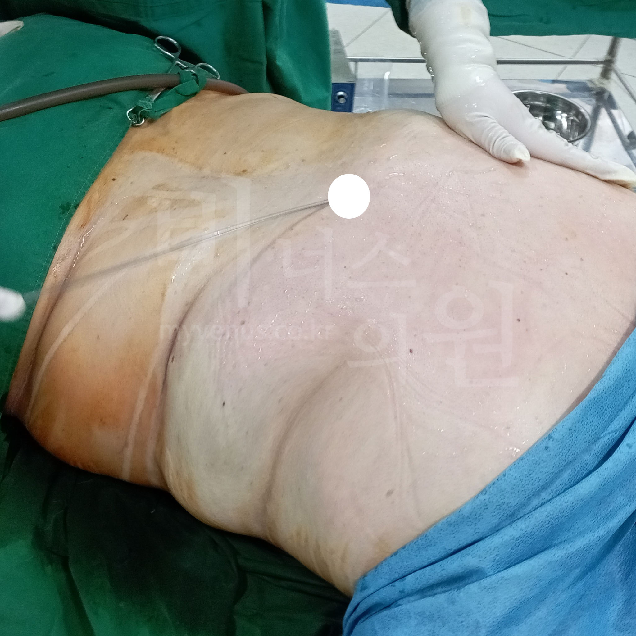 슬림한 복부.JPG