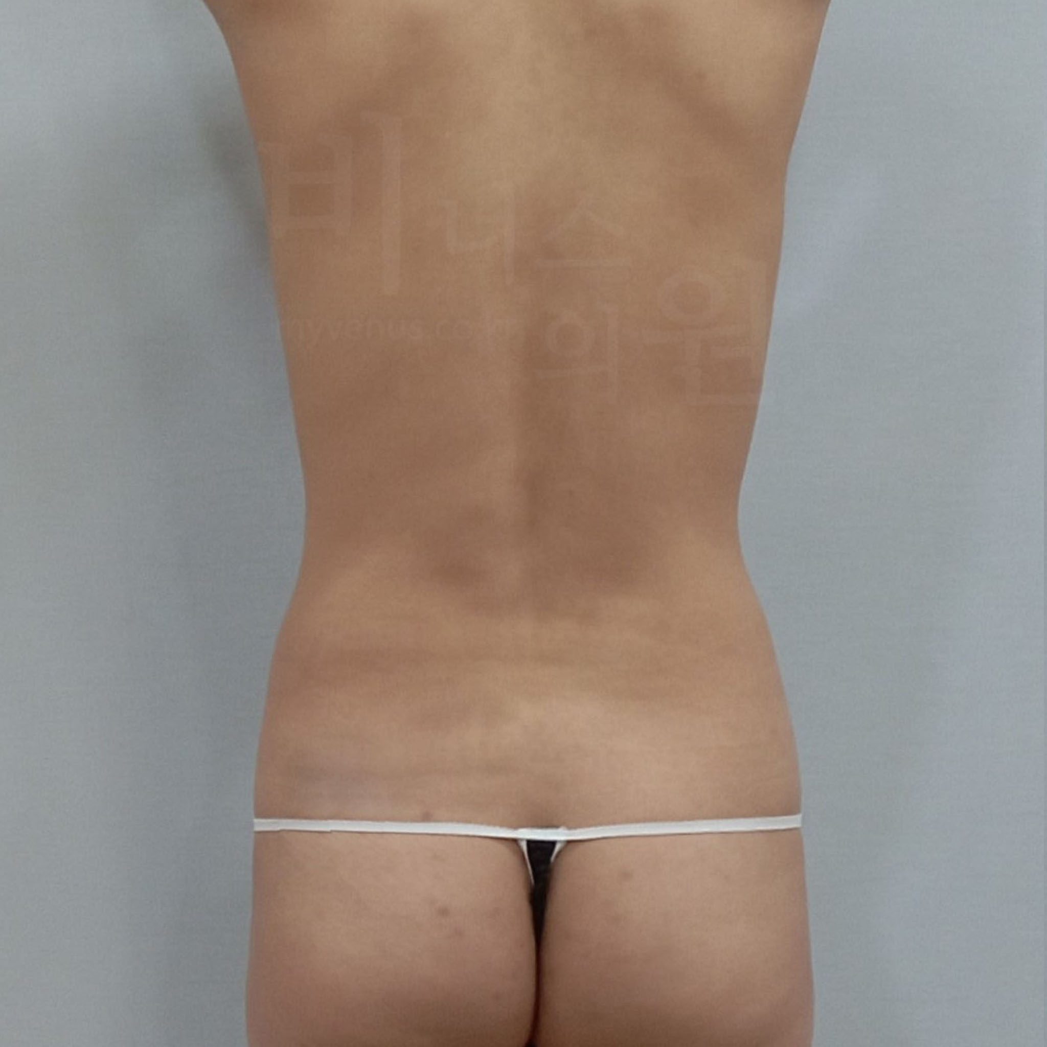 복부 탄력 개선.JPG