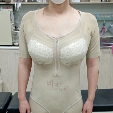 가슴 지방흡입 압박복.jpg