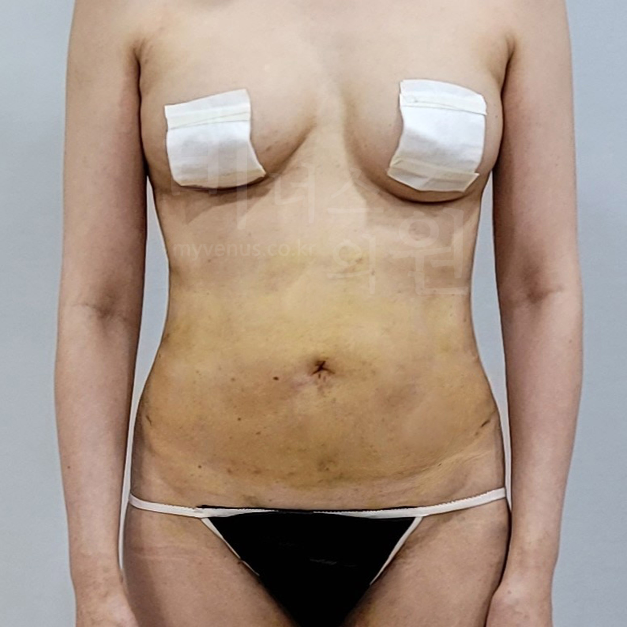 복부 옷맵시.jpg