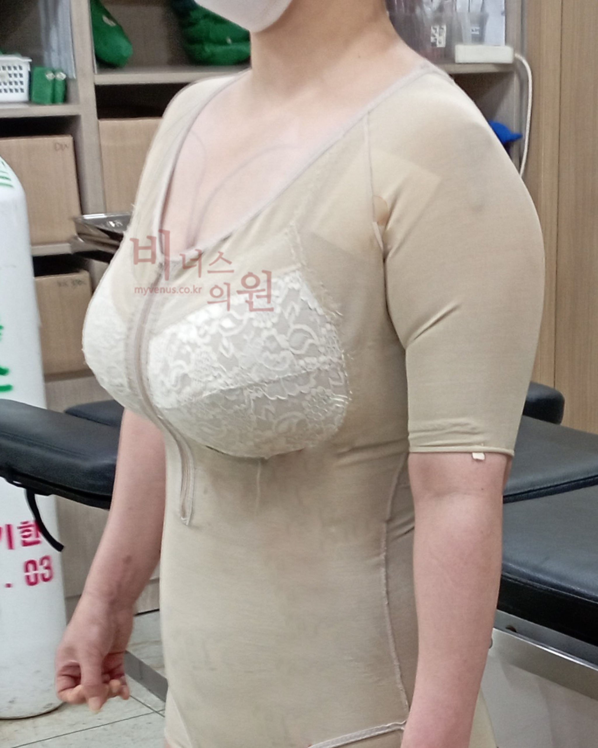 가슴 지방흡입 압박복.jpg