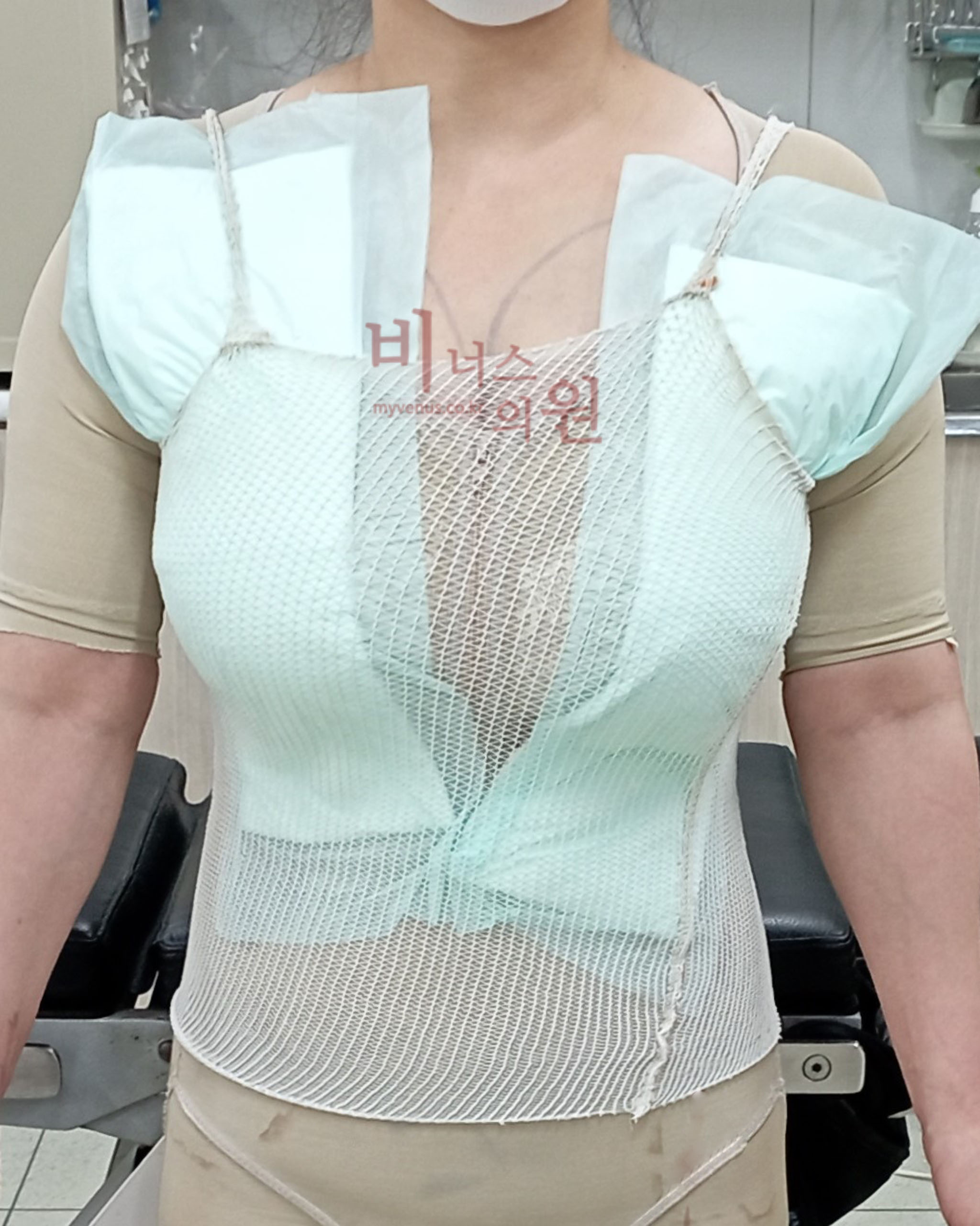 가슴 지방흡입 압박복.jpg
