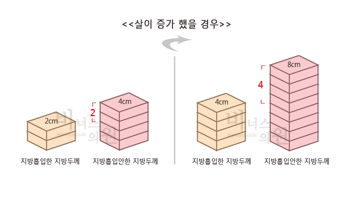 요요현상