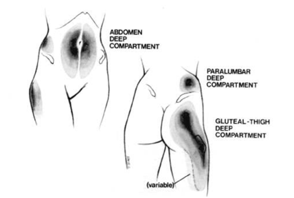 지방의 축적부위